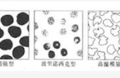 Intrinsic factors affecting moisture regain of textile fibers